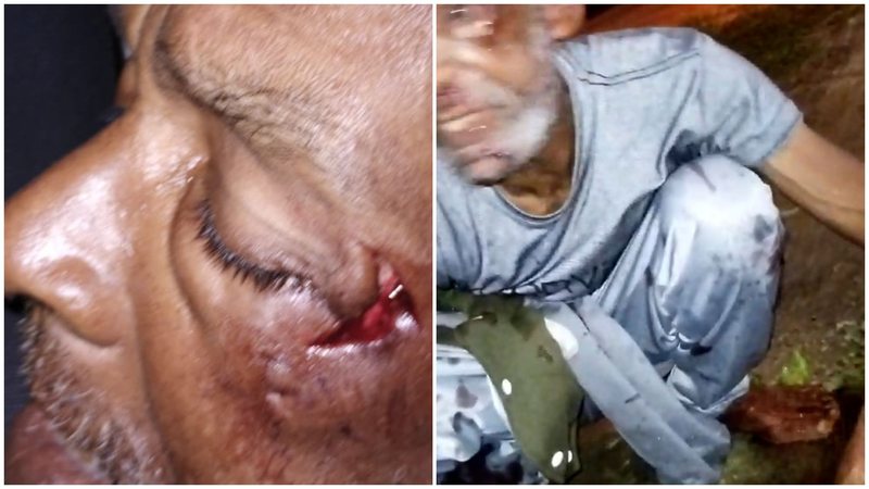 Imagens cedidas por familiares mostram Raimundo ensanguentado e com corte profundo no rosto após ser espancado - Imagem: Acervo Familiar Raimundo da Silva / Reprodução