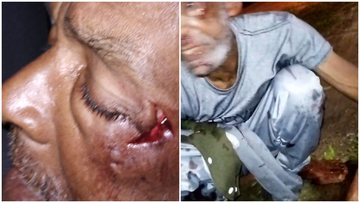 Imagens cedidas por familiares mostram Raimundo ensanguentado e com corte profundo no rosto após ser espancado - Imagem: Acervo Familiar Raimundo da Silva / Reprodução