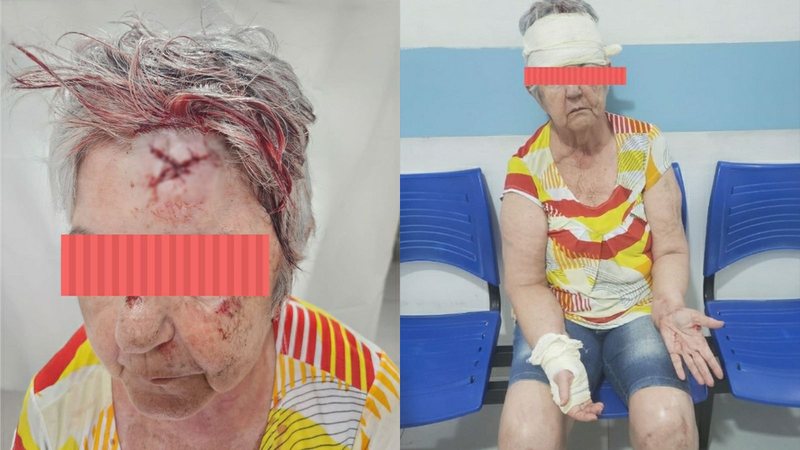 A mulher precisou levar seis pontos de sutura na testa e dois na mão - Imagens: Arquivo Pessoal