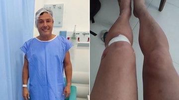 Vavá passou por cicurgia no ligamento cruzado anterior (LCA) do joelho esquerdo - Reprodução Instagram/Vavacantor