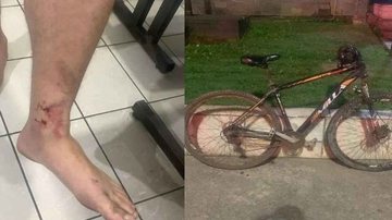 Vítimas empurravam bicicletas com compras; ambos tiveram ferimentos leves - Reprodução/Polícia Civil