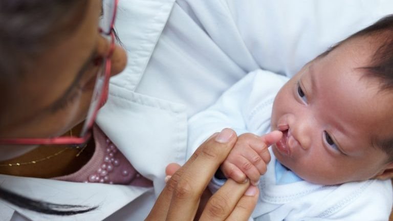Tratamento gratuito deverá incluir cirurgia e atendimentos complementares essenciais para a recuperação dos pacientes - Imagem ilustrativa/Getty Images
