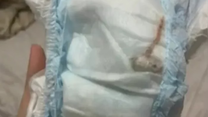 objeto-encontrado-em-fralda-de-bebe-no-rj-nao-era-um-rato-confira-o-que-era