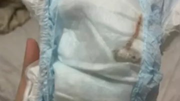 objeto-encontrado-em-fralda-de-bebe-no-rj-nao-era-um-rato-confira-o-que-era
