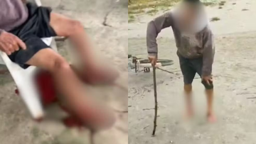 ataque-de-cachorros-deixa-homem-com-pernas-dilaceradas-em-guaruja