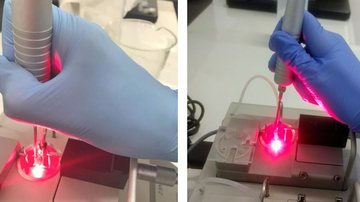 Laser pode ajudar a reduzir hipertensão ligada à menopausa