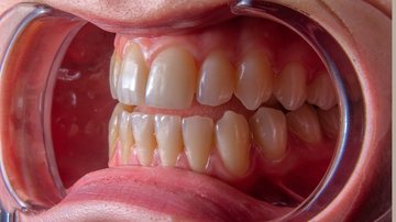 Dentes humanos