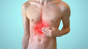 Diverticulite é uma inflamação intestinal, caracterizada pela inflamação ou infecção dos divertículos - Pixabay