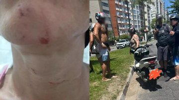 Linha de pipa fere motociclista no pescoço e quase causa tragédia em Santos
