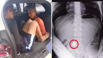 Jovem engole corrente de ouro após roubá-la e é preso com comparsa, no Guarujá