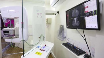 Sala de mamografia com aparelho de exame e monitor exibindo imagens das mamas