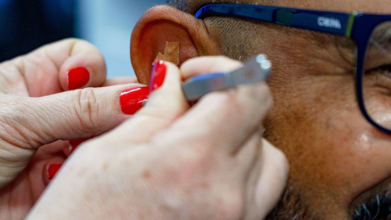 aplicação de auriculoterapia