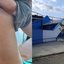 Imagem à esquerda mostra escoriações no corpo do menor; na imagem à direita a faixada da Centro de Educação Infantil