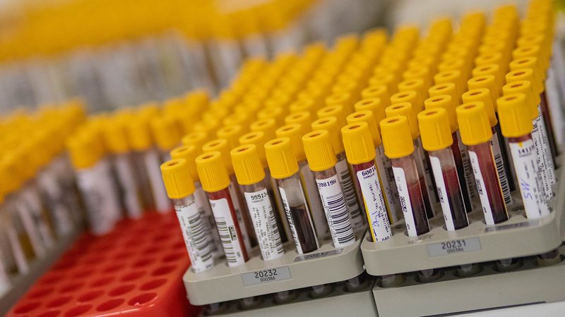 Depósitos de sangue enfileirados