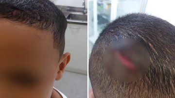 Menino é atingido por trave em Santos - Reprodução/Internet