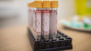 Covid-19: Pfizer e BioNTech pedem uso emergencial de vacina na Europa - © Reuters/Direitos Reservados