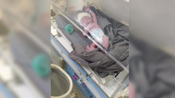 Apesar de ter vindo ao mundo dramaticamente, bebê recém-nascido passa bem, na maternidade de Bertioga. - Foto: JCN