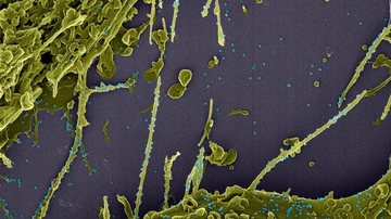 Estudo constata infecção simultânea por duas linhagens do coronavírus - © LMMV/IOC/Fiocruz