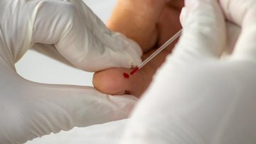 Imagem São Sebastião realiza mais de 35 mil testes rápidos para detectar Covid-19