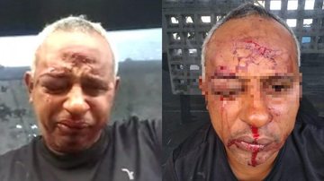 Porteiro ia para igreja quando foi severamente agredido por idoso e filho, Idoso espanca porteiro covardemente em Santos (SP) - Imagem: Reprodução / Marcelo Ricky Oficial Instagram