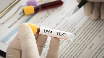 Teste de DNA - Reprodução/Sindiregis