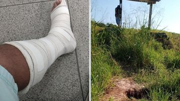 Homem cai em buraco de 1,70m ao tentar chegar em ponto de ônibus em Itanhaém - Arquivo pessoal