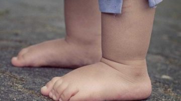 Tios acusados de tortura e agressão a bebê de um ano viram réus em Caraguatatuba (SP) - Foto: Reprodução Internet