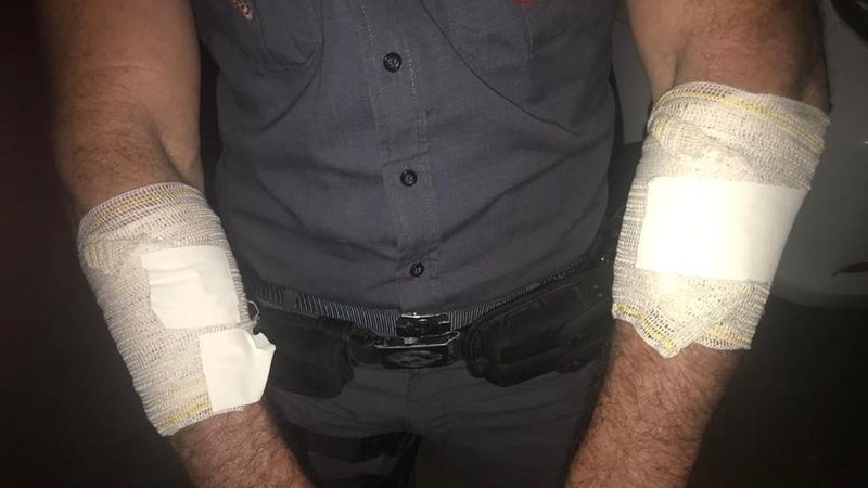 Policial foi atingindo pelo homem durante o confronto - Foto: Polícia Militar