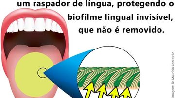 Biofilme lingual invisível - Dr. Maurício Conceição