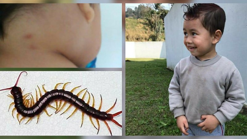 Criança de 2 anos é morta por lacraia  mosaico de fotos, criança em pé, picada do inseto e a lacraia - Arquivo Pessoal