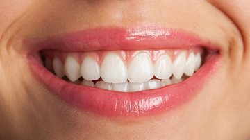 Cirurgiã-dentista explica como identificar a gengivite e por que ela pode pontencializar a disseminação da covid-19 CAPA - Gengivite pode contribuir para a proliferação do coronavírus, diz especialista - Imagem: Reprodução / Freepik