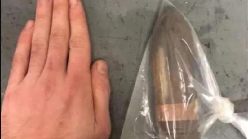 Projétil entra 'misteriosamente' em reto de paciente que escorregou em sala de coleção de armamentos - Reprodução
