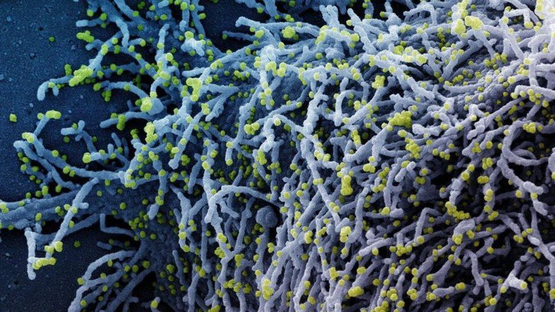 © National Institute of Allergy and Infectious Diseases /NIAID/Direitos reservados - © National Institute of Allergy and Infectious Diseases /NIAID/Direitos reservados