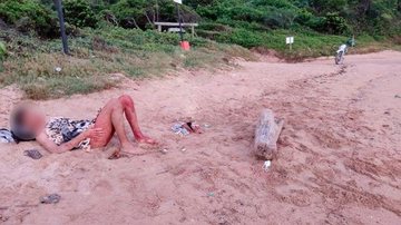 Rapaz encontrado na praia após luau em Guarapari (ES) Rapaz com barriga aberta Rapaz deitado na praia esperando atendimento médico - Reprodução