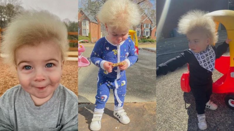 Condição rara parece não afetar desenvolvimento da criança 'Põe sorriso no rostos das pessoas', diz mãe de bebê com mutação rara do cabelo impenteável bebê com condição rara nos cabelos - Imagem: LOCKLAN SAMPLES/INSTAGRAM