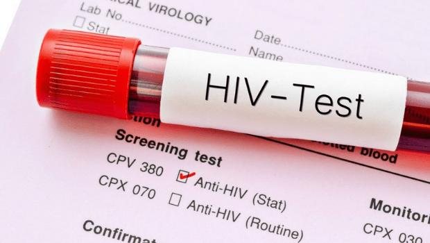 Suspeito de transmitir HIV a mulheres de propósito é preso em Goiás Teste de HIV - Imagem Ilustrativa: Reprodução / Agência Aids