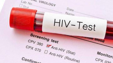 Suspeito de transmitir HIV a mulheres de propósito é preso em Goiás Teste de HIV - Imagem Ilustrativa: Reprodução / Agência Aids