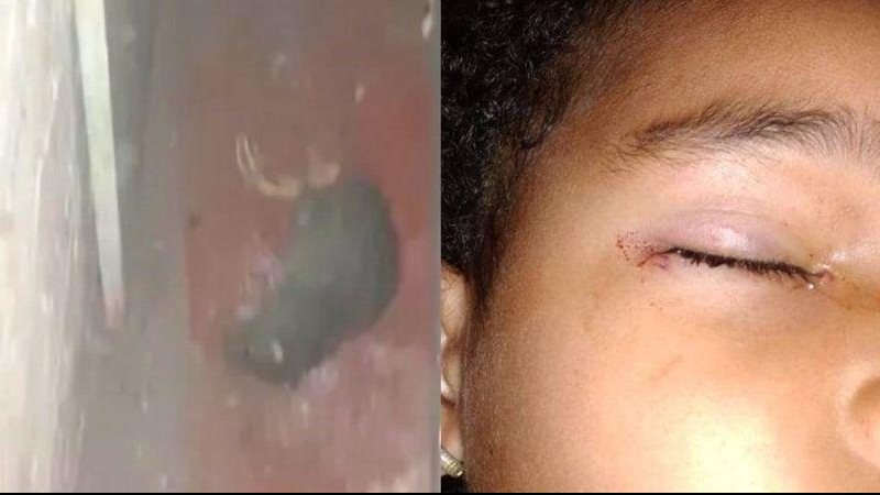 "Eu pensei que minha filha ia perder a visão", contou a mãe da criança Rato ataca menina de 3 anos enquanto ela dormia Rato morto no chão e outra foto do olho da criança ensanguentado - Reprodução