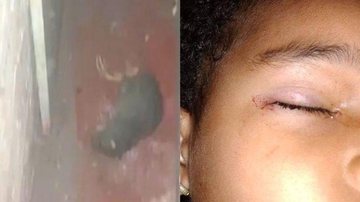 "Eu pensei que minha filha ia perder a visão", contou a mãe da criança Rato ataca menina de 3 anos enquanto ela dormia Rato morto no chão e outra foto do olho da criança ensanguentado - Reprodução