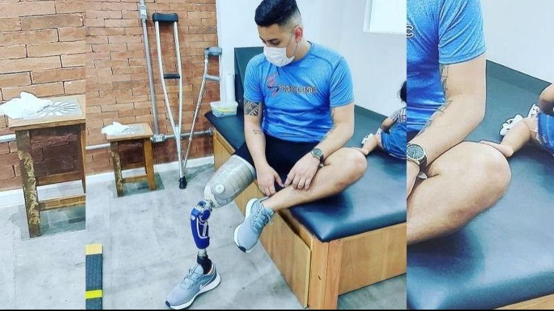 Jovem afirma que acreditou na promessa de um empresário do litoral e depois foi "passado para trás" Jovem com prótese Jovem com camiseta azul e perna a espera da prótese - Arquivo Pessoal