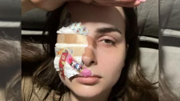 Médico passou um colírio para os olhos e remédios para diminuir a dor além de m tampão por no mínimo três dias Influencer com córnea 'rasgada' Influencer deitada com um tampão em um dos olhos - Reprodução