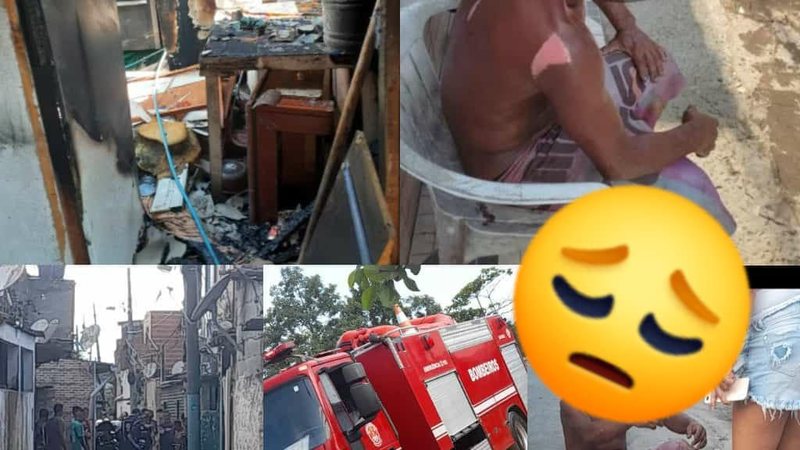 Homem cuida dos dois filhos de sete e cinco anos e faz bicos para sobreviver Homem perde tudo em incêndio Homem com o corpo machucado devido ao incêndio à direita e casa incendiada à esquerda - Reprodução