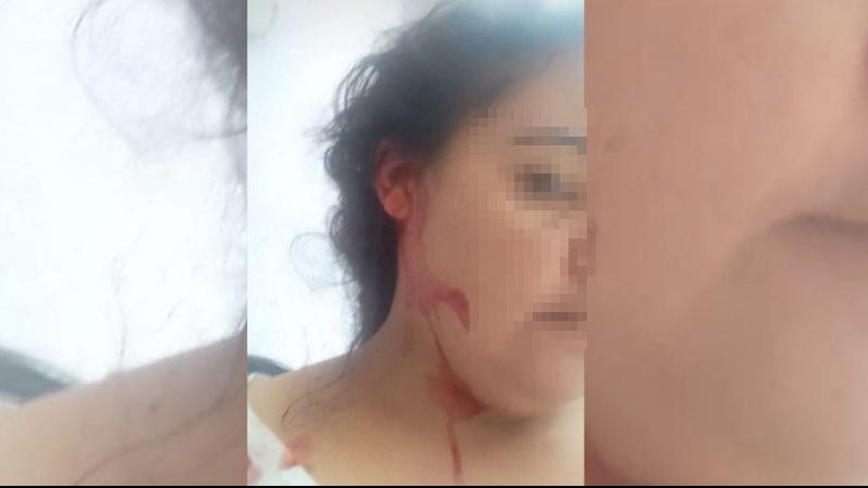 Vítima foi mordida, levou pedradas e socos no rosto Vítima Mulher com sangue na cara - Arquivo Pessoal
