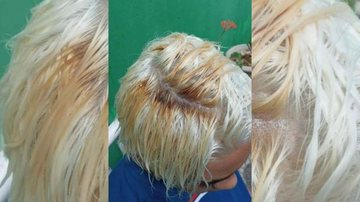 Mãe ficou indignada com o resultado no cabelo do filho que evitou de ir à escola envergonhado Resultado do cabelo Cabelo platinado e queimado - Arquivo Pessoal