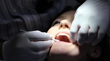 Acompanhamento odontológico durante a gravidez é importante para proteger as vidas da mãe e da criança Dentista Dentista examinando a boca de uma mulher - Reprodução/Pxhere