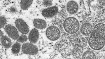 Vírus causador da varíola dos macacos visto através de microscópio Ministério da Saúde diz que Brasil possui 8 casos suspeitos de varíola dos macacos Imagem do vírus causador da varíola dos macacos visto pelo microscópio - Reprodução/Cynthia S. Goldsmith, Russell Regner/CDC via AP
