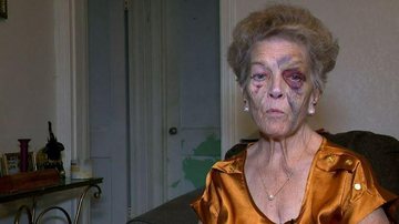 Idosa de 72 anos teve diversos hematomas em seu rosto ao ter o carro roubado em um posto de gasolina Idosa Idosa espancada - Divulgação