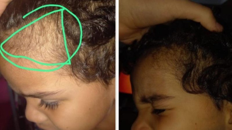 Mãe estava em compromisso importante quando recebeu mensagem avisando que a criança chorava achando estar com calvice - Facebook