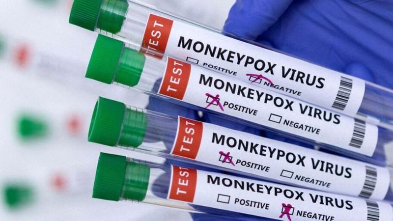 Santos ainda possui 11 casos suspeitos da doença Santos totaliza 16 casos de varíola dos macacos após nova notificação da doença Tubos de ensaio com testes para monkeypox - © REUTERS/Dado Ruvic