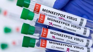 Paciente masculino de 37 anos foi diagnosticado com a doença em agosto e sua morte foi confirmada na noite de ontem (15) Varíola dos Macacos no litoral - Reprodução Internet